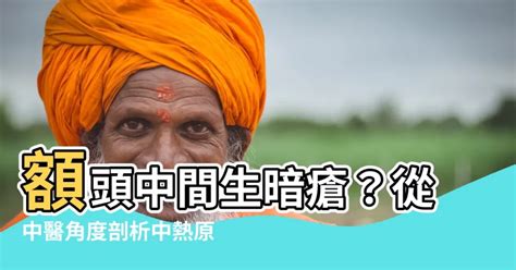 額頭中間生暗瘡|額頭暗瘡 7 大解決方法！皮膚專家親授秘訣+預防貼士